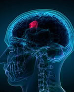 Providence Saint Joseph Medical Center - Howard and Hycy Hill Neuroscience Institute image